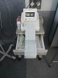 陣痛の強さや間隔と胎児の心拍数を測る機械。これは日本と同じですね。